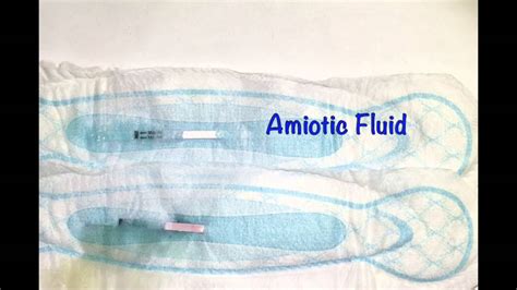 how to know if amniotic fluid is leaking|Amniotic Fluid: What is It and Signs of Leaking